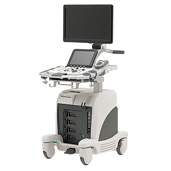 超音波診断装置